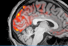 科学家发现在睡眠过程中脊液冲洗过大脑