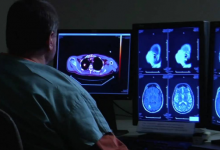 IBM Watson Health推出FDA认可的解决方案的Imaging AI市场
