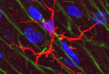 小鼠实验显示大脑中常见的免疫细胞可能在记忆中起关键作用