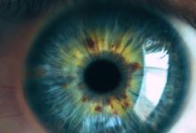 CRISPR首次使用在患者眼中治疗遗传性盲症