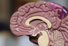 Neuralink将在下个月分享将人脑与AI连接的进展