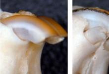 研究人员发现一种让小鼠牙齿再生的方法