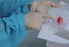 日常生活：核酸检测一次多少钱多久出结果