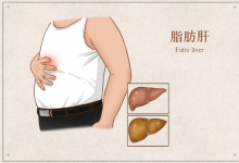 瘦子竟然也会有脂肪肝？改善看看水飞蓟作用吧