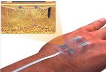 UConn研究人员设计了新的无线智能绷带来治愈伤口