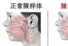 武汉民生耳鼻喉医院靠谱吗？技术一流服务温馨患者感动满意获无数肯定