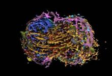 这种开创性的人类细胞分裂模型可以帮助治愈癌症