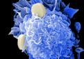 研究显示增强免疫系统对抗黑色素瘤的新策略