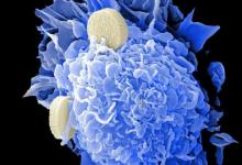 研究显示增强免疫系统对抗黑色素瘤的新策略