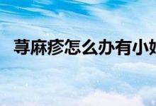 荨麻疹怎么办有小妙招吗(荨麻疹怎么办)