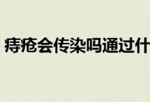 痔疮会传染吗通过什么传染(痔疮会传染吗)