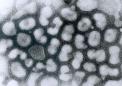 研究发现对流感的免疫通路反应与遗传血统之间的关系