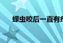 蠓虫咬后一直有疙瘩（蠓虫怎么驱赶）