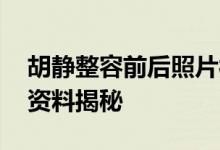 胡静整容前后照片被扒 富豪老公朱兆祥个人资料揭秘