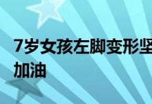 7岁女孩左脚变形坚持跳舞 她患了什么病为她加油