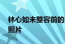 林心如未整容前的照片 林心如整容前后对比照片