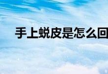 手上蜕皮是怎么回事（为什么手上蜕皮）