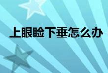 上眼睑下垂怎么办（怎么改善上眼睑下垂）