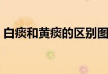 白痰和黄痰的区别图解（白痰和黄痰的区别）