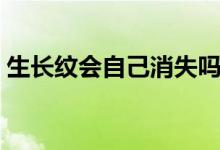 生长纹会自己消失吗（生长纹会自己消除吗）