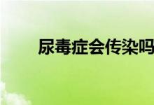 尿毒症会传染吗（尿毒症会传染吗）