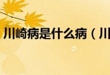 川崎病是什么病（川崎病的发病原因是什么）