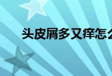 头皮屑多又痒怎么办（如何去屑止痒）