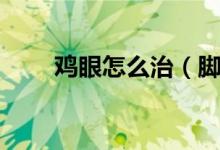 鸡眼怎么治（脚上的鸡眼怎么治疗）