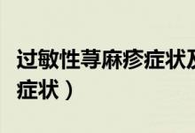 过敏性荨麻疹症状及治疗方法（过敏性荨麻疹症状）