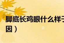 脚底长鸡眼什么样子图解（脚底长鸡眼什么原因）