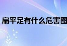 扁平足有什么危害图片（扁平足有什么危害）