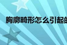 胸廓畸形怎么引起的(胸廓畸形怎么回事)