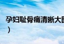 孕妇耻骨痛清晰大图（孕妇耻骨痛是什么原因）