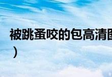 被跳蚤咬的包高清图（被跳蚤咬的包什么样子）