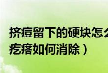 挤痘留下的硬块怎么消除（挤痘肿了成一个硬疙瘩如何消除）
