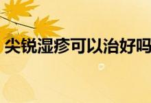 尖锐湿疹可以治好吗（尖锐湿疹可以治好吗）