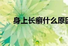 身上长癣什么原因（身上长癣的症状）