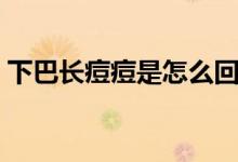 下巴长痘痘是怎么回事（下巴长痘痘的原因）