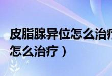 皮脂腺异位怎么治疗能上药膏吗（皮脂腺异位怎么治疗）