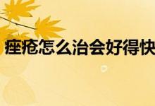 痤疮怎么治会好得快（痤疮怎么治会好的快）