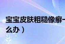 宝宝皮肤粗糙像癣一样（宝宝皮肤粗糙像癣怎么办）