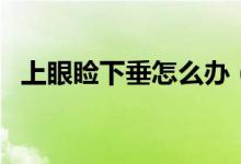 上眼睑下垂怎么办（怎么改善上眼睑下垂）