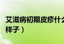 艾滋病初期皮疹什么样(艾滋病初期皮疹什么样子)