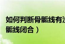 如何判断骨骺线有没有完全闭合(如何判断骨骺线闭合)