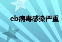 eb病毒感染严重(EB病毒感染严重吗)
